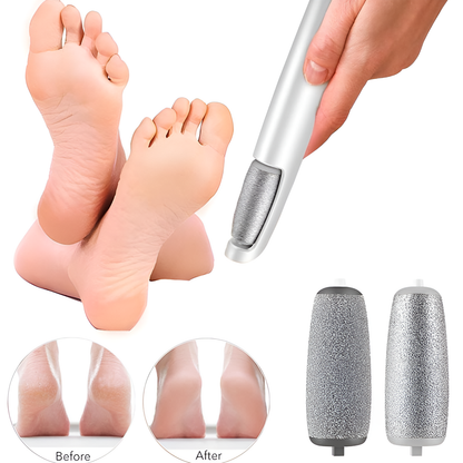 Electric Callus Remover + 1 FREE Anti-Cracking Foot Cream + 6 FREE Foot Care Guides Files